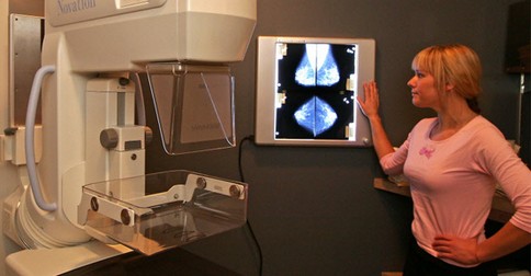 Klasický mamograf